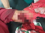 Seorang Warga Watuliandu Kolaka Diduga Jadi Korban Penganiayaan