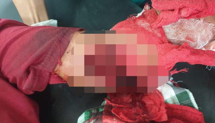 Seorang Warga Watuliandu Kolaka Diduga Jadi Korban Penganiayaan