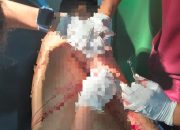 Dendam Lama Berujung Penikaman di Kendari, Pelaku Ditangkap