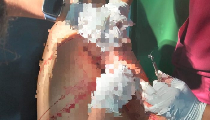 Dendam Lama Berujung Penikaman di Kendari, Pelaku Ditangkap