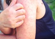 Darurat HIV Sultra: Kasus Tembus 2.900, Wagub Hugua Soroti 1.000 ODHA Tak Berobat Rutin