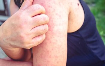 HIV/AIDS, Sulawesi Tenggara (Sultra)