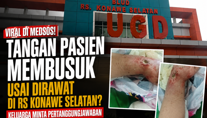 Viral! Diduga Salah Infus, Tangan Pasien Membusuk Usai Dirawat di RSUD Konawe Selatan